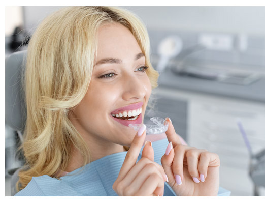 SureSmile aligners