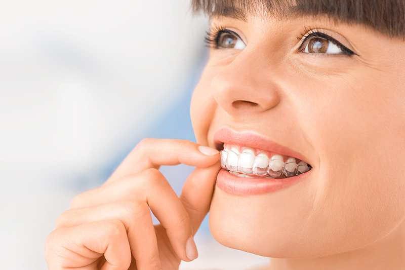 Invisalign in Orland Park