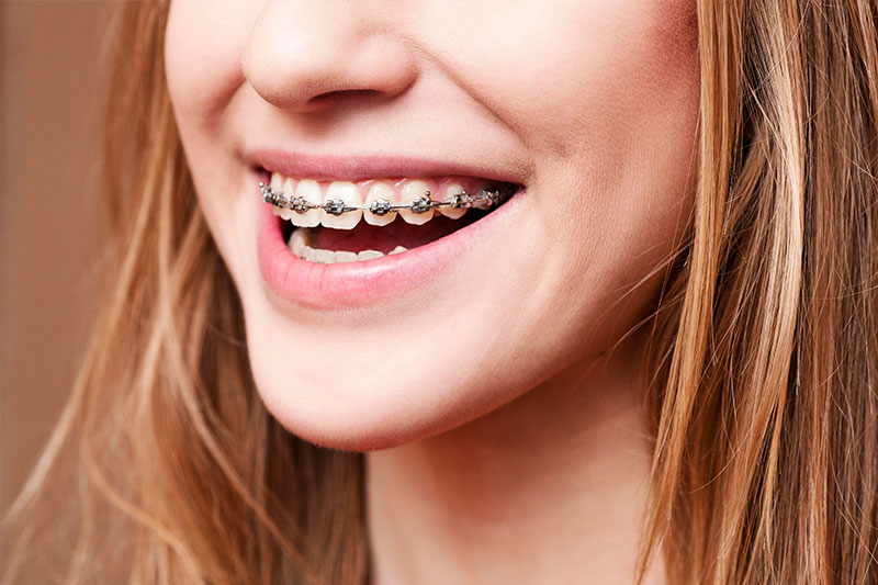 Orthodontics in Orland Park