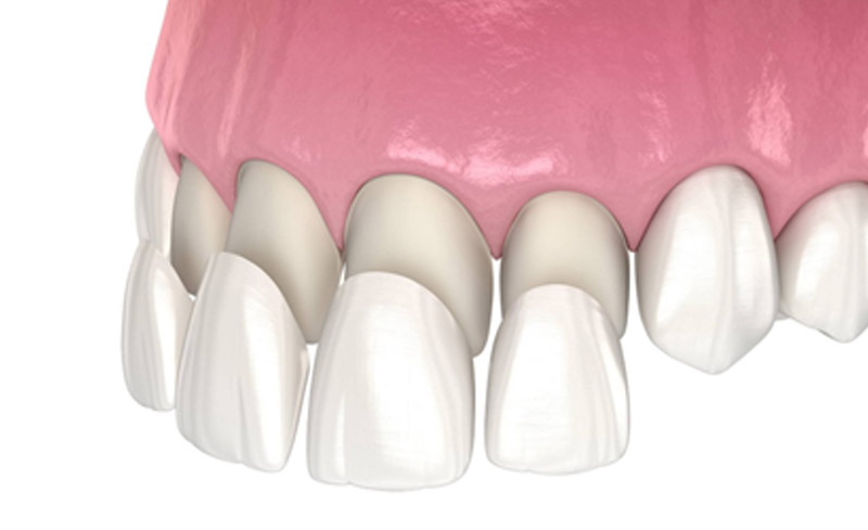 Cosmetic Dentistry in Orland Park