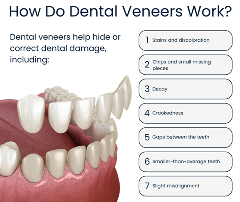 Cosmetic Dentistry in Orland Park
